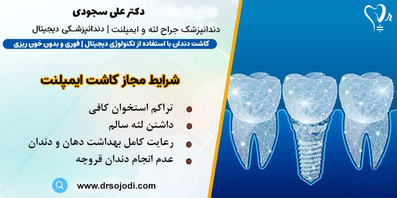 ایمپلنت فوری دکتر سجودی