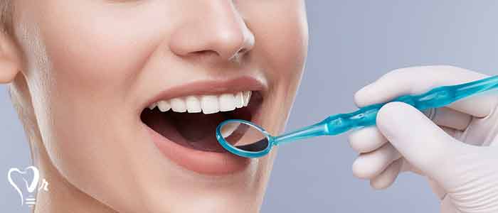 فاز نگهداری پریودونتال - چه کسی باید مراقبت نگهداری periodontal را انجام دهد؟