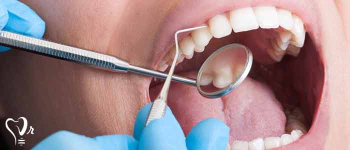 فاز نگهداری پریودونتال - در خلال یک جلسه نگهداری periodontal چه چیزی انجام می شود؟