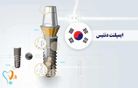 معرفی کامل ایمپلنت کره ای دنتیس | همه‌چیز درباره برند، محصولات و دوام