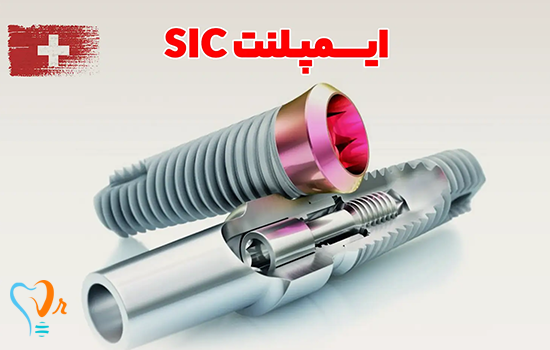 ایمپلنت SIC سوئیسی | بررسی قیمت، کیفیت و اطلاعات کامل