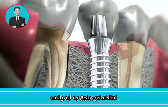 دانلود فایل صوتی اطلاعات مفید راجع به ایمپلنت 
