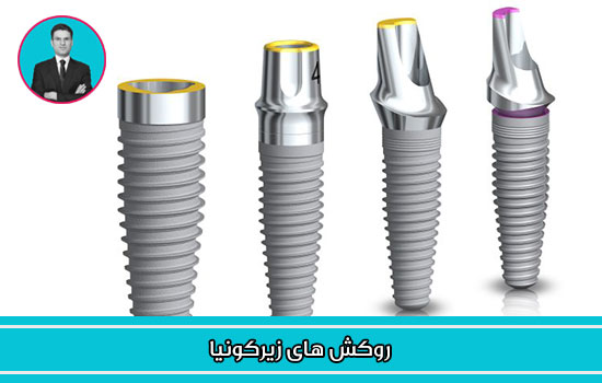 روکش های زیرکونیا 
